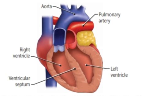 Congenital Defects Flashcards Quizlet