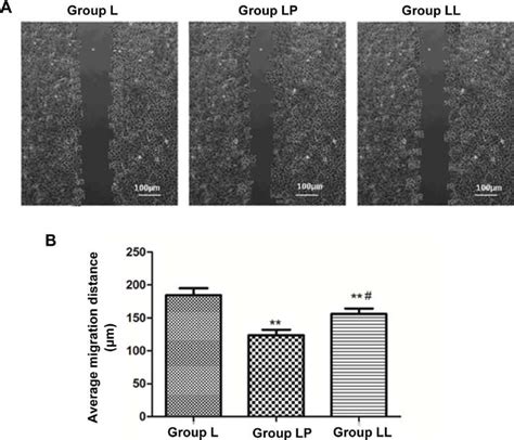 Detection Of Cell Migration Capability Via Cell Wound Scratch Assay