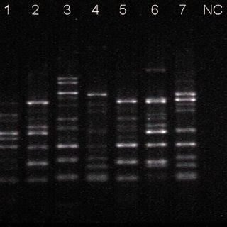 Eric Pcr Profiles Of Escherichia Coli Isolates From Yolk Sac Infection