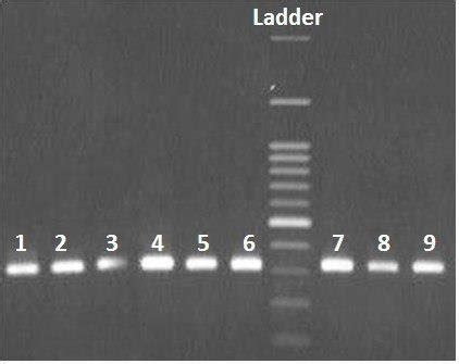 Agarose Gel Electrophoresis Analysis Of 16S RRNA Gene Amplified From