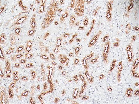 Epithelial Membrane Antigen Ema Histology Slides