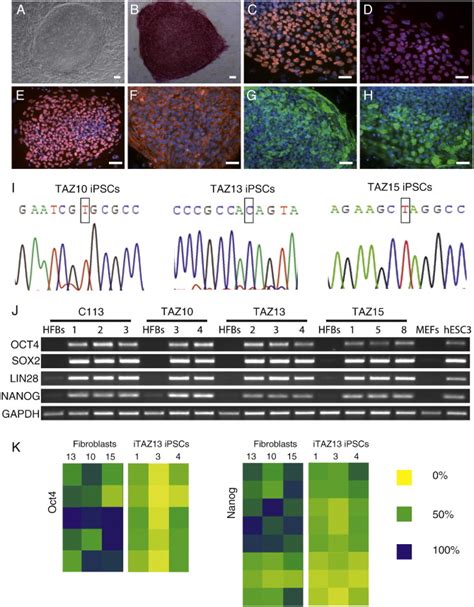 Characterization Of Patient Specific Ipscs A A Representative Human