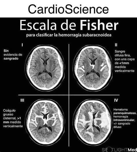 Seccion Cardio Science