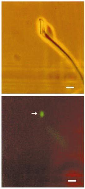 Matching A Phase Contrast And B Fluorescent Light Micrographs Of