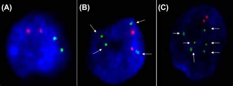 Interphase Fluorescence In Situ Hybridization Analysis Of Uncultured