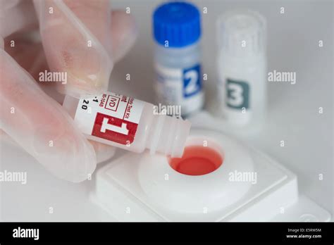 Hiv Rapid Test Hi Res Stock Photography And Images Alamy