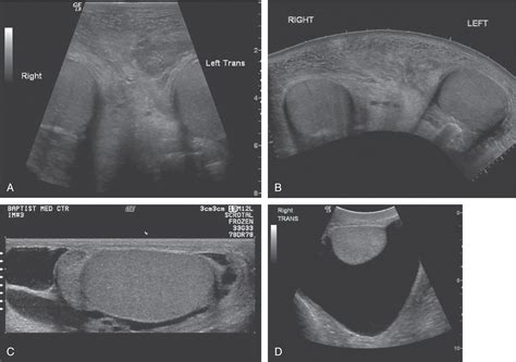 Scrotum Clinical Tree