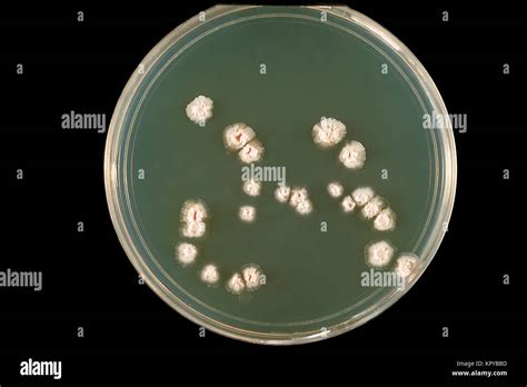 Infecciones De Nocardia Fotograf As E Im Genes De Alta Resoluci N Alamy