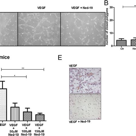 NAADP Pathway Inhibition Impairs Of VEGF Induced Vessel Formation In