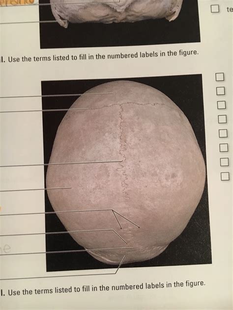 Superior View Of The Skull Diagram Quizlet