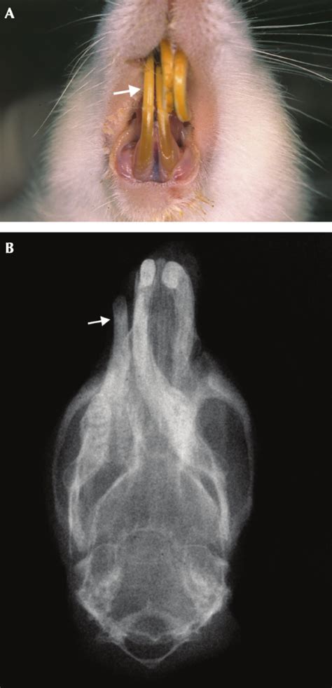 A Representative Rat No 21 With Class Ii Malocclusion In Cisor Download Scientific