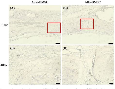 Figure From Allogeneic Bone Marrow Mesenchymal Stem Cell With