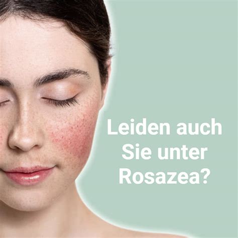 Ichthraletten Beruhigt Rosazea Haut Von Innen Heraus