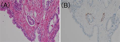 Frontiers Clinicopathological Analysis Of The ISUP Grade Group And