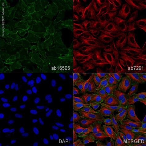 Anti Pan Cadherin Antibody Ab Abcam