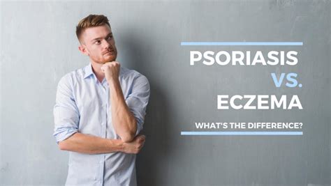 Psoriasis Vs Eczema Whats The Difference Psoriasis Honey