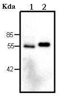 Lipoprotein Lipase Assay试剂盒 Fluorometric Abcam中文官网