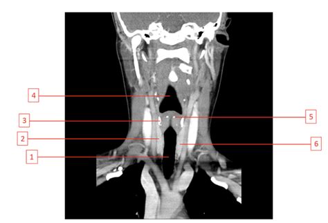 Ct Neck Diagram Quizlet