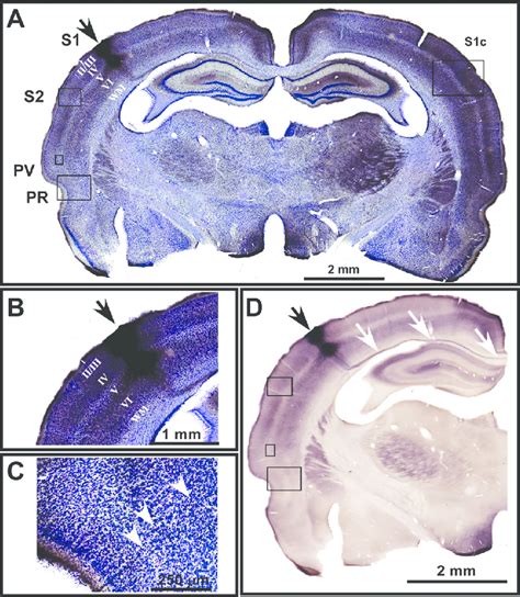 Histological Rat Brain Section Doublestained With Nissl Showing The