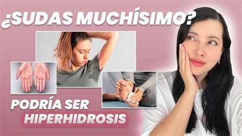 SUDAS MUCHÍSIMO Te cuento de la HIPERHIDROSIS CÓMO CONTROLAR