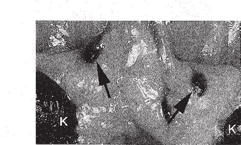 Figure 2 from Structure and function of the hemolymph node in rats. | Semantic Scholar