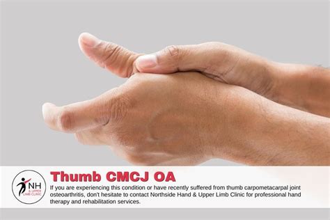 Managing Carpometacarpal Joint Osteoarthritis with Hand Therapy ...