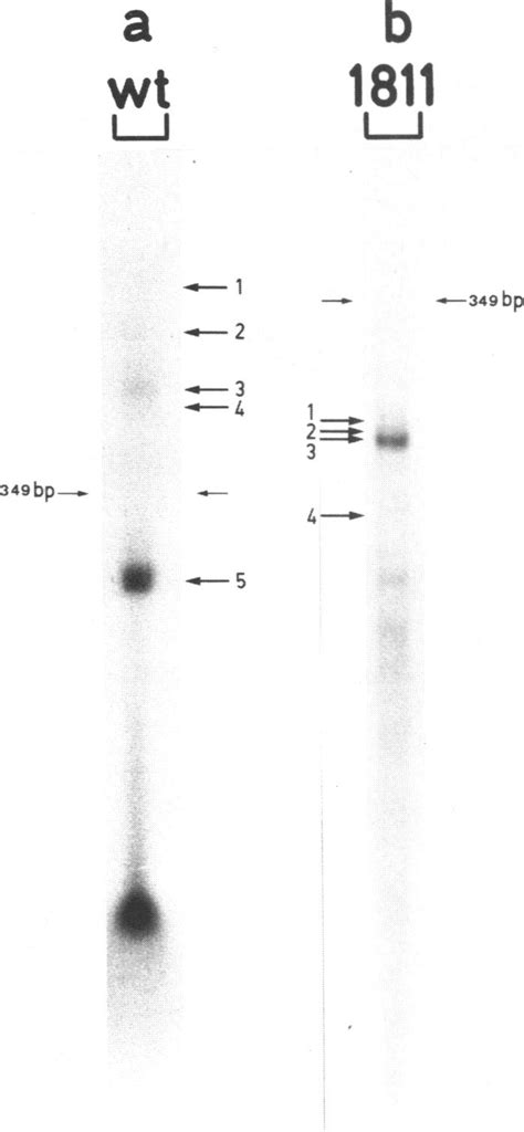 Fractionation By Electrophoresis Of 32p Labeled S1resistant Rna Dna