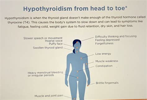 Iodine Patch Test For Hypothyroidism Christiane Northrup Md