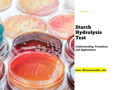 Starch Hydrolysis Test Understanding Procedure And Applications