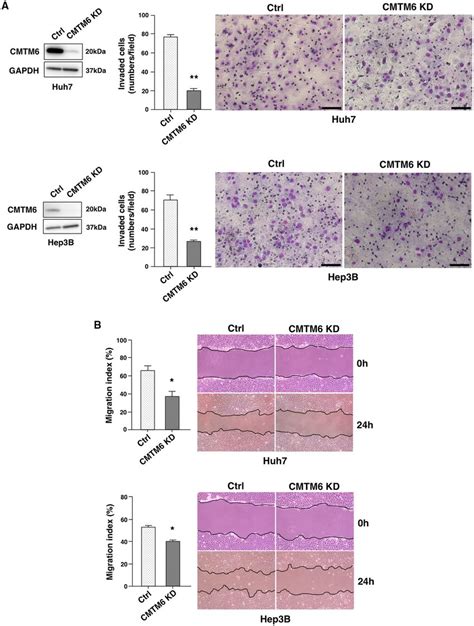 Cmtm Promotes Hcc Cell Motility Cmtm Knockdown Significantly