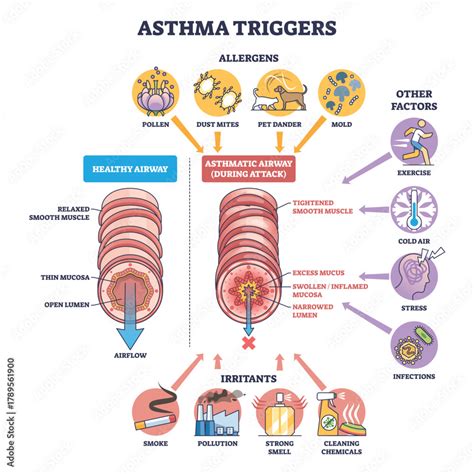 asthma triggers diagram shows healthy  asthmatic airway