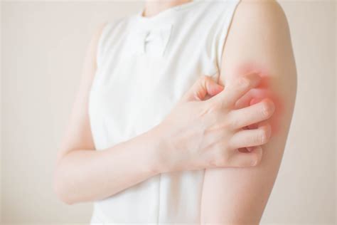 A Guide To Skin Infections - Arlington Dermatology