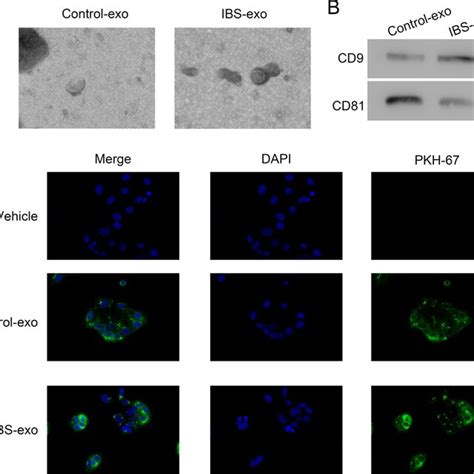 Isolation And Characterization Of Exosomes A Exosome Morphology B