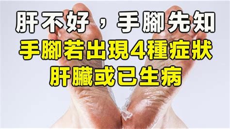 肝不好，手腳先知！手腳若出現4種症狀，肝臟或已生病 Youtube