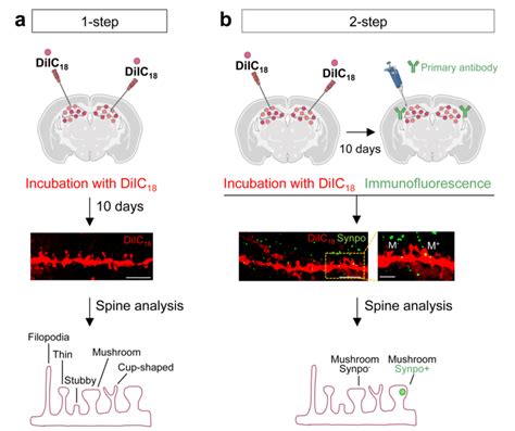 Workflow Of DiIC18 Staining Combined With Fluorescent Immunolabeling