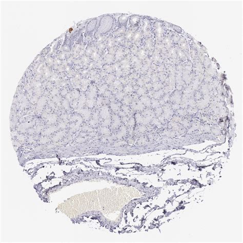 Tissue expression of EGFR - Staining in stomach - The Human Protein Atlas