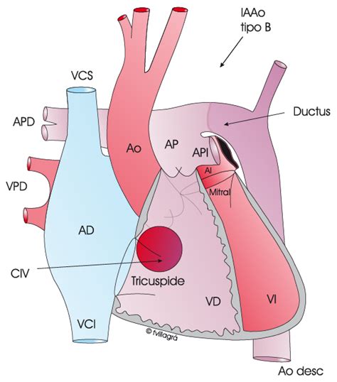 Tipos De Cardiopat As Cong Nitas Web De Cardiopat As Cong Nitas