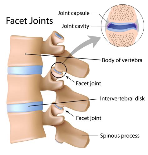 Facet Joint Pain Back Care Clinic