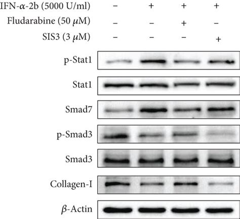 Crosstalk Between Stat1p21 And Tgfβsmad Signaling Pathways A