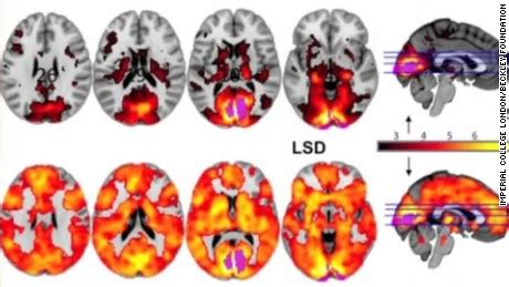 What effects does LSD have on our brain? - CNN Video