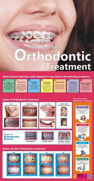 Orthodontic Treatment Eng Ldp 06 Smart Doc Posters