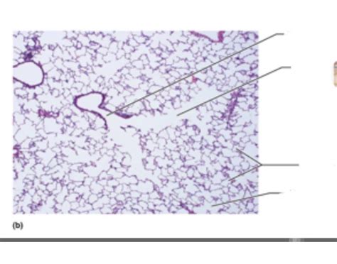 Alveoli Microscope slide Quiz