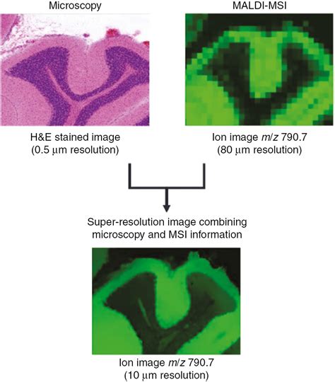 Cellular Resolution In Clinical Maldi Mass Spectrometry Imaging The Latest Advancements And