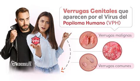 Diagnóstico y Tratamientos para el Papiloma Humano VPH Quito