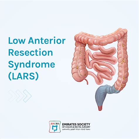 Low Anterior Resection