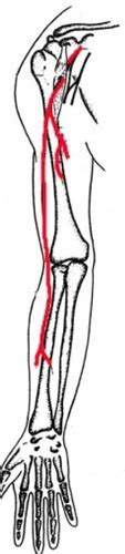 Nerven Der Oberen Extremit Ten Plexus Brachialis Flashcards Quizlet