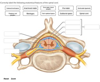 Answered: Correctly label the following anatomical features of the spinal cord. Dura mater ...