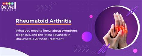 Rheumatoid Arthritis What You Need To Know About Symptoms Diagnosis