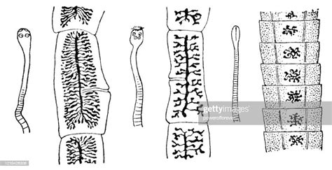 Various Types Of Tapeworms 19th Century High-Res Vector Graphic - Getty ...