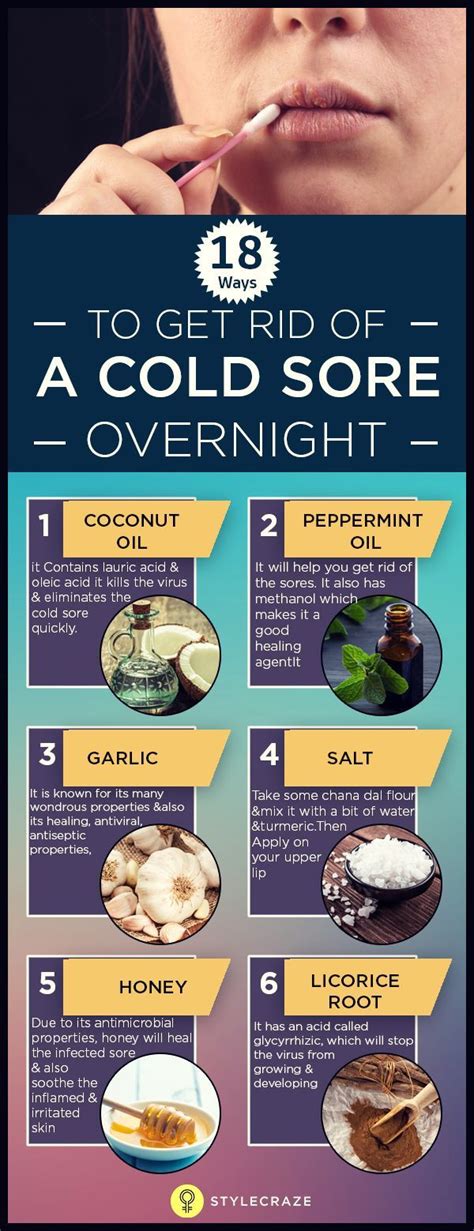 Ideal Tips About How To Get Rid Of Cold Sore Swelling - Westhoney53